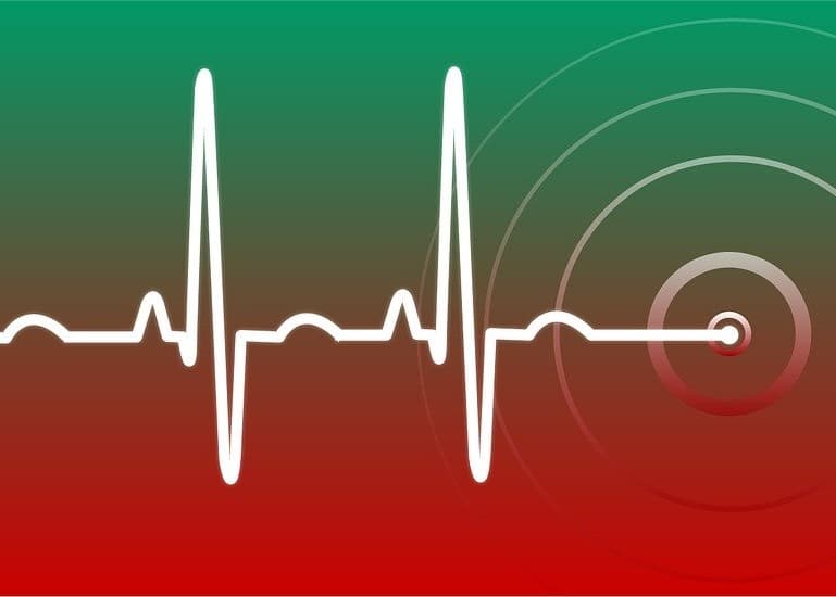 sonda EKG