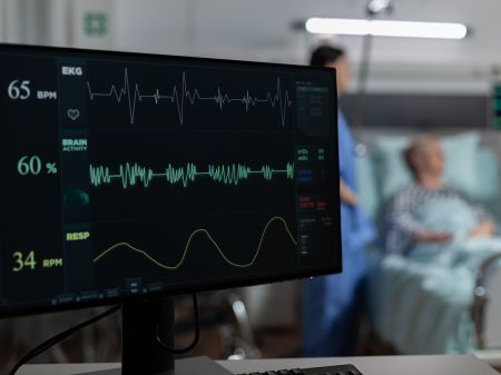 monitor-na-oddziale-szpitalnym-pokazujacy-bmp-od-pacjenta