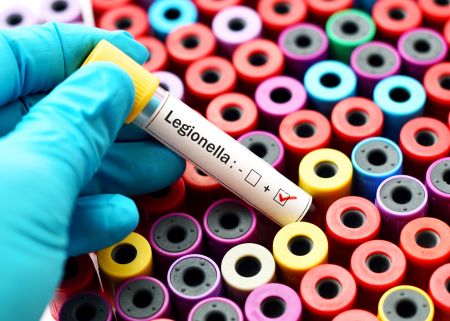 legionella