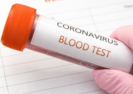 test na koronawirusa